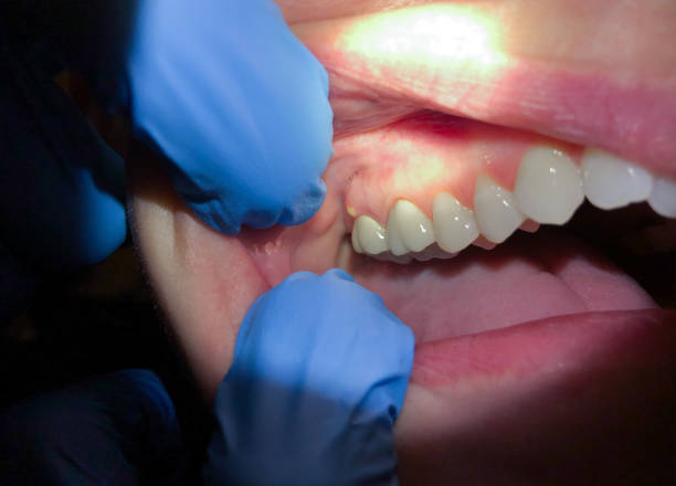 Best Emergency Cosmetic Dentistry in Dudley, NC