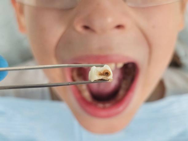 Best Broken or Cracked Tooth Emergency Dentist in Dudley, NC